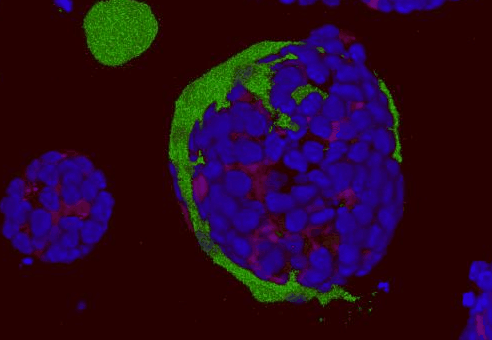 Three-dimensional rendering of fibroblasts interacting with basal cell organoids